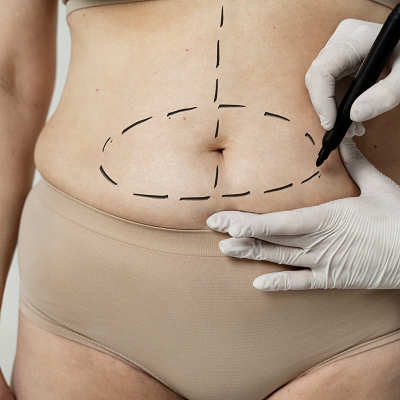 Best Bariatric Surgeon in Islamabad