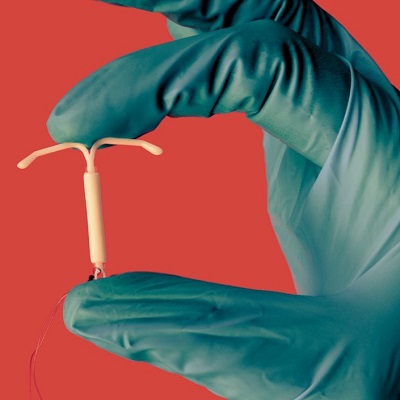 IUD Insertion Copper in Islamabad