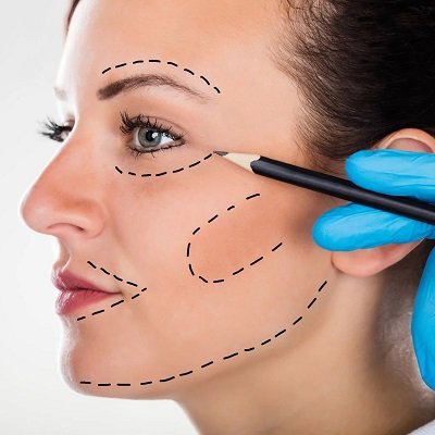 Is It Hard to Smile After a Facelift in Islamabad?