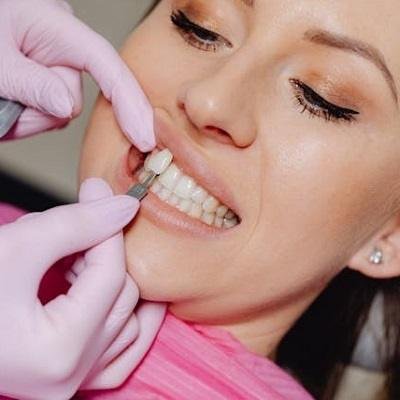 Do implants require special toothpaste?