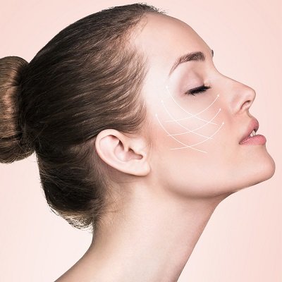 Is Thread Lift Better Than Botox in Islamabad?