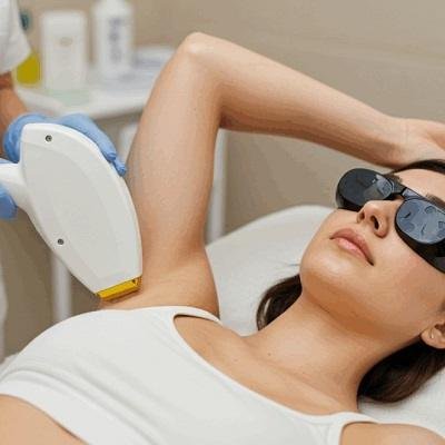 Is it okay to laser pubic hair?