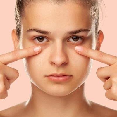What is the Best Treatment For Dark Circles in Islamabad