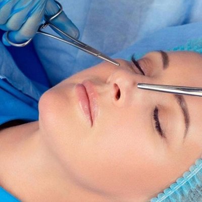 What is the Difference Between a Nose Job and a Rhinoplasty