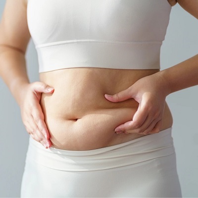 Abdominoplasty Cost in Islamabad