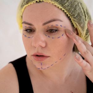 Best Thread Face Lift in Islamabad