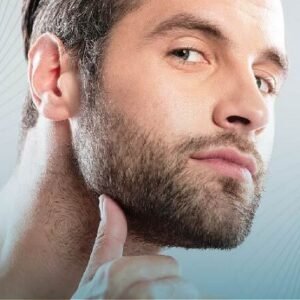 Can a Beard Transplant Fail