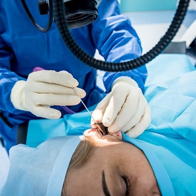 Can I Sleep on My Ear After Tympanoplasty?