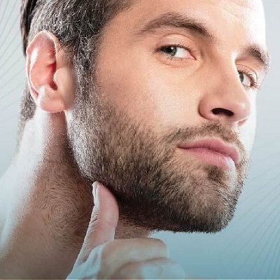 Can a Beard Transplant Fail?