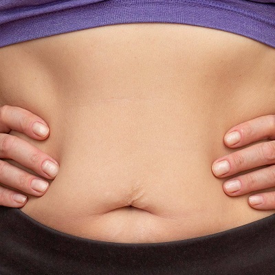 Does Tummy Tuck Remove Fat?