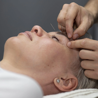 How acupuncture helps in relieving migraine pain?