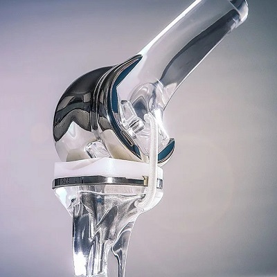 How painful is a total knee replacement?