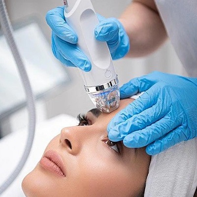 Virtue RF Microneedling Before and After