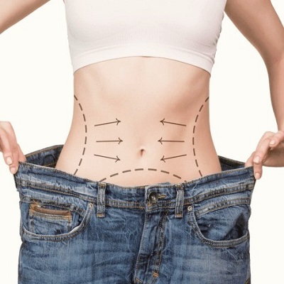 What is the minimum weight for bariatric surgery?