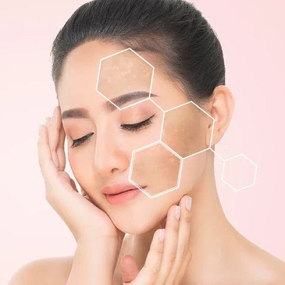 Can skin pigmentation turn cancerous?