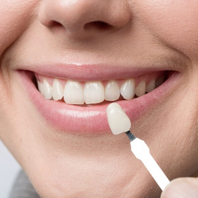 Can you eat normally when you have veneers