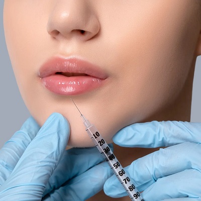 Can You Feel Sick After Fillers?