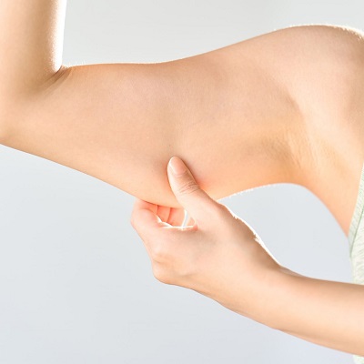 Can flabby arms really be toned?