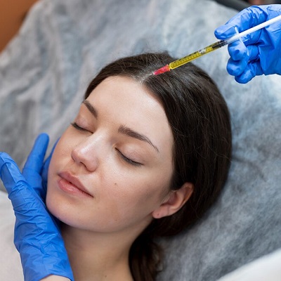 How Long After PRP Does Hair Grow Back?