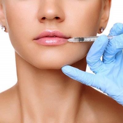 How long can fillers stay in your body?