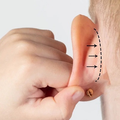 Is a Mastoidectomy Considered a Serious Surgery?