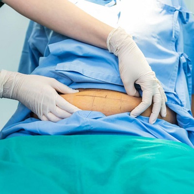 What is Laparoscopic Surgery Used For?