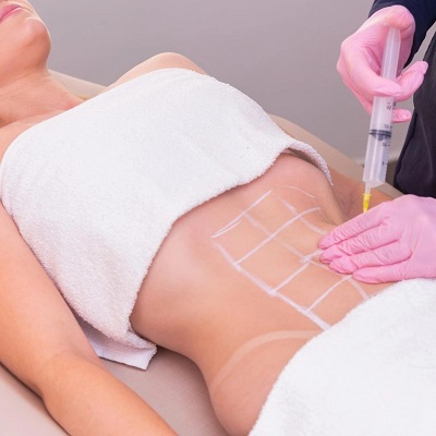 Which body filler is best?