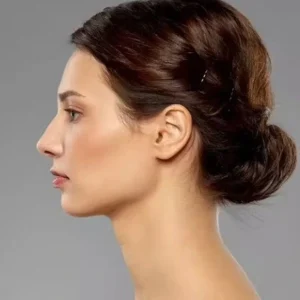 Can I smile 3 weeks after Rhinoplasty?