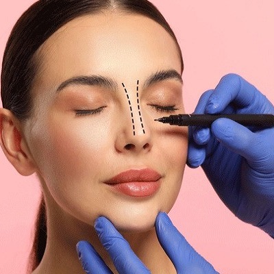 Can Rhinoplasty Be Reversed?