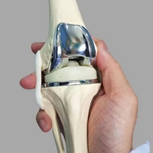 Time to Walk Normally After Knee Replacement