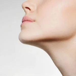 Is Belkyra Better Than Chin Liposuction for Fat Removal?