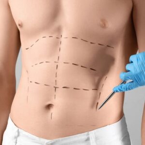 Tummy Tuck or Lower Body Lift: Which Is Right