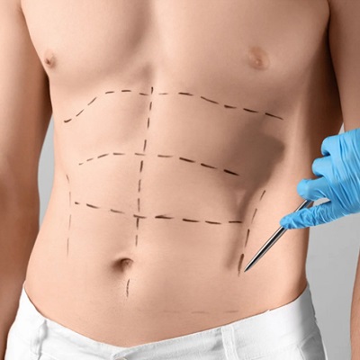 Tummy Tuck or Lower Body Lift: Which Is Right