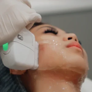 What Is a Hifu Facial and Does It Really Work?