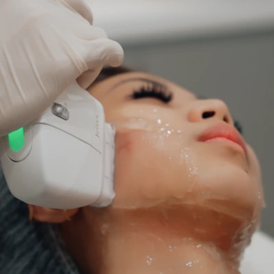 What Is a Hifu Facial and Does It Really Work?