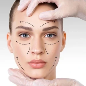 What is a Cinderella Facelift?