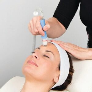 Will Microdermabrasion Remove Blackheads