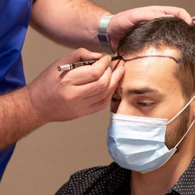 hair treatment in Islamabad